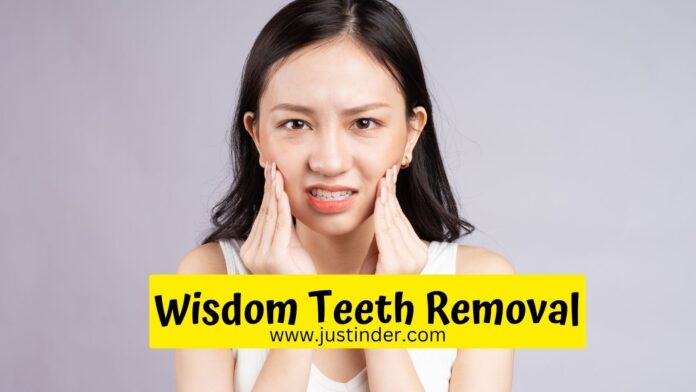 Can I brush My Teeth After Wisdom Teeth Removal